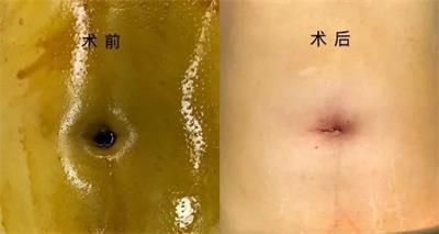 罗勇  妇科   1752669822999_xYYBAF7FP6eAKSqtAABcTvzz-EU466.jpg