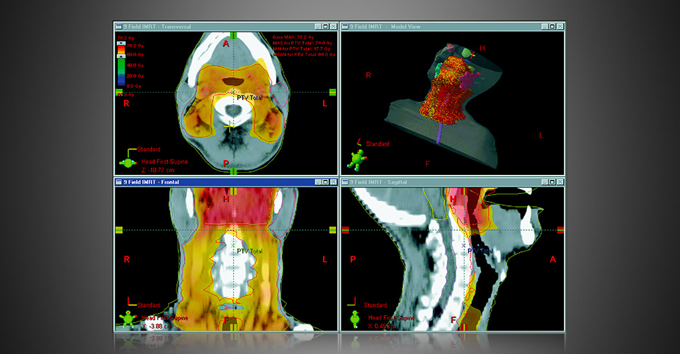 Oncology_Tx_Planning_Eclipse_004_960x500.jpg