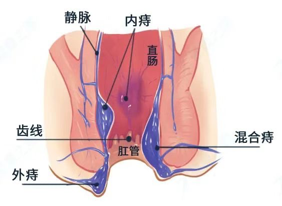 1702630760183770.png 图片4.png