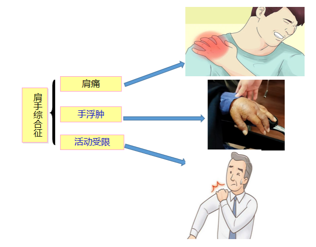 1703237282149795.png 图片6.png