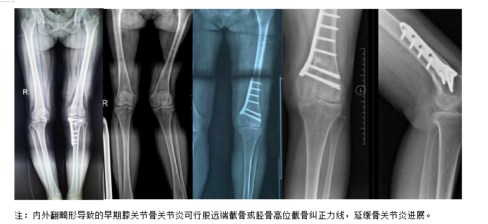 1703758933462823.png QQ截图20231228181839.png