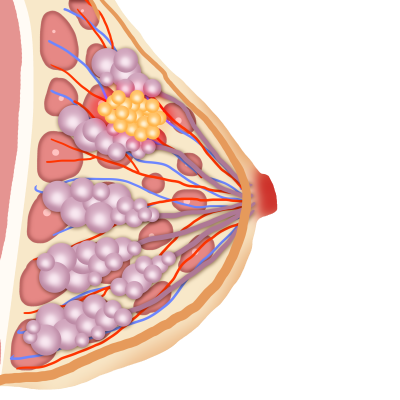 千库网_女性乳腺肿瘤_元素编号12953768.png