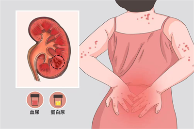 1722389008252435.png 图片3.png
