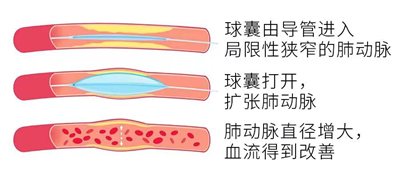 1727684191985827.png 图片4.png