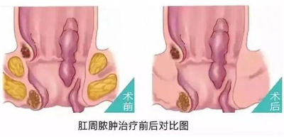 1732008993145455.png 图片4.png