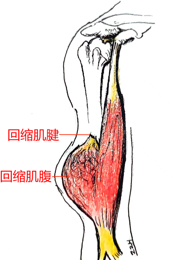 1732603648804690.png 图片4.png