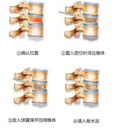 1733798432865774.png 图片7.png