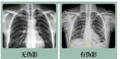 1734405370112771.png 图片1.png