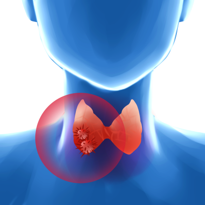 1734407644139495.png 千库网_甲状腺癌癌症_元素编号13027865.png