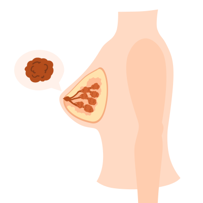 1735009981470651.png 千库网_女性健康乳腺增生_元素编号12895117.png