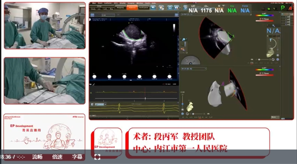 心血管内科  直播演示.png