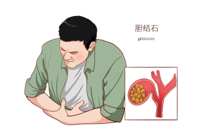 千库网_常见医疗人物疾病图例胆结石_元素编号14589911_看图王.png
