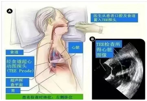1766981165998159.png 图片2.png